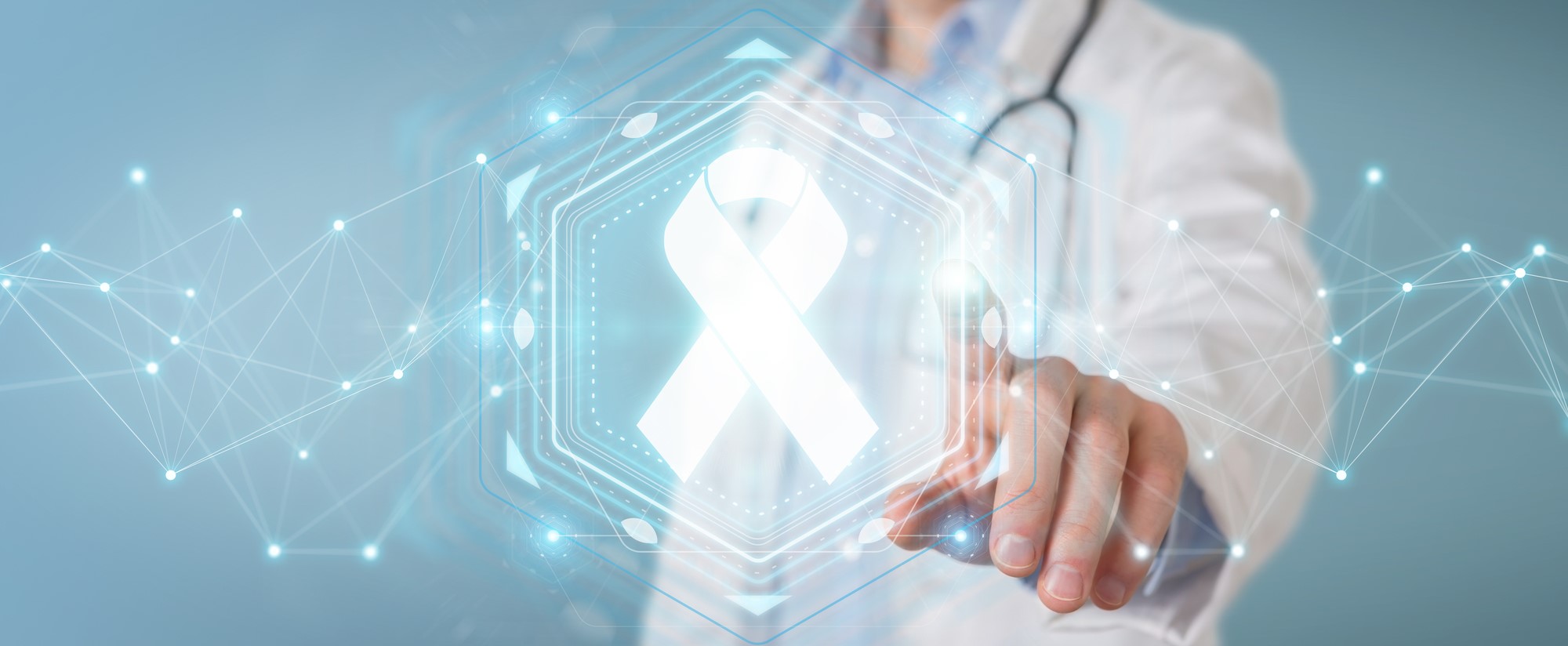 Xạ trị lập thể định vị thân bằng CyberKnife hỗ trợ điều trị ung thư phổi