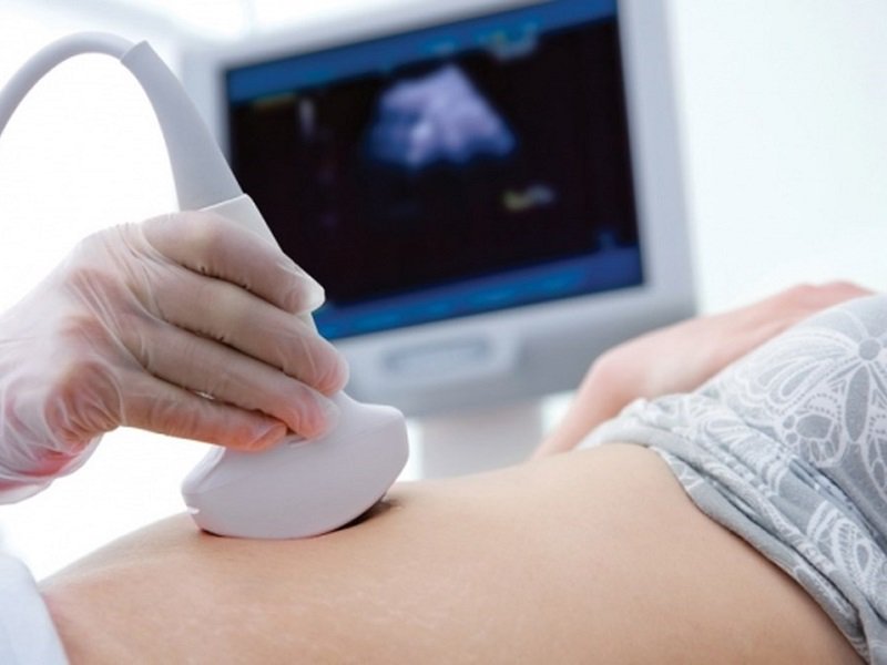 Công nghệ siêu âm thai Voluson E8 hàng đầu thế giới